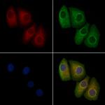 Phospho-ErbB2 (HER-2) (Tyr1196) Antibody in Immunocytochemistry (ICC/IF)