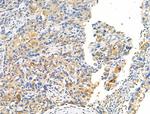 Phospho-ErbB2 (HER-2) (Tyr1196) Antibody in Immunohistochemistry (Paraffin) (IHC (P))