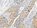 Phospho-ErbB2 (HER-2) (Tyr1196) Antibody in Immunohistochemistry (Paraffin) (IHC (P))