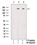 Phospho-ErbB2 (HER-2) (Tyr1196) Antibody in Western Blot (WB)