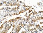 Phospho-Cytokeratin 20 (Ser13) Antibody in Immunohistochemistry (Paraffin) (IHC (P))