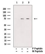 Phospho-L-Plastin (Tyr28) Antibody in Western Blot (WB)