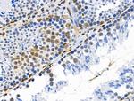 Phospho-MEK1 (Thr286) Antibody in Immunohistochemistry (Paraffin) (IHC (P))