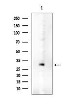 Phospho-C2orf33 (Ser172, Ser146) Antibody in Western Blot (WB)