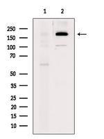 Phospho-NMDAR2B (Ser1284) Antibody in Western Blot (WB)