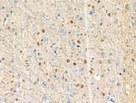 Phospho-NPM1 (Thr95) Antibody in Immunohistochemistry (Paraffin) (IHC (P))