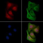 Phospho-NuMA (Ser395) Antibody in Immunocytochemistry (ICC/IF)