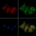 Phospho-PAK1/PAK2 (Ser199, Ser204, Ser192, Ser197) Antibody in Immunocytochemistry (ICC/IF)