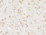 Phospho-PAK1/PAK2 (Ser199, Ser204, Ser192, Ser197) Antibody in Immunohistochemistry (Paraffin) (IHC (P))