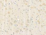 Phospho-PAK2 (Ser20) Antibody in Immunohistochemistry (Paraffin) (IHC (P))