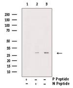 Phospho-RAC1 (Ser71) Antibody in Western Blot (WB)