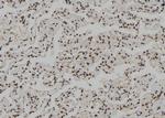 Phospho-Rb (Ser608) Antibody in Immunohistochemistry (Paraffin) (IHC (P))