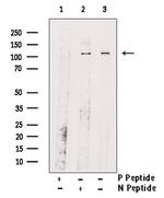 Phospho-Rb (Ser608) Antibody in Western Blot (WB)