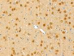 Phospho-Rb (Ser608) Antibody in Immunohistochemistry (Paraffin) (IHC (P))