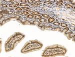 Phospho-Rb (Ser608) Antibody in Immunohistochemistry (Paraffin) (IHC (P))