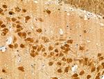 Phospho-Rb (Ser608) Antibody in Immunohistochemistry (Paraffin) (IHC (P))