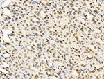 Phospho-Rb (Ser608) Antibody in Immunohistochemistry (Paraffin) (IHC (P))