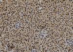 Phospho-SF3B1 (Thr313) Antibody in Immunohistochemistry (Paraffin) (IHC (P))