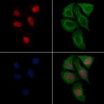 Phospho-SF3B1 (Thr313) Antibody in Immunocytochemistry (ICC/IF)