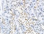 Phospho-SF3B1 (Thr313) Antibody in Immunohistochemistry (Paraffin) (IHC (P))