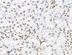 Phospho-SF3B1 (Thr313) Antibody in Immunohistochemistry (Paraffin) (IHC (P))