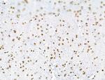 Phospho-SF3B1 (Thr313) Antibody in Immunohistochemistry (Paraffin) (IHC (P))