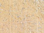 Phospho-SHIP2 (Tyr1135) Antibody in Immunohistochemistry (Paraffin) (IHC (P))