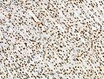 Phospho-SKP2 (Ser64) Antibody in Immunohistochemistry (Paraffin) (IHC (P))