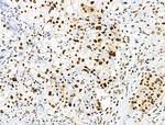 Phospho-SKP2 (Ser64) Antibody in Immunohistochemistry (Paraffin) (IHC (P))