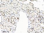 Phospho-SKP2 (Ser64) Antibody in Immunohistochemistry (Paraffin) (IHC (P))