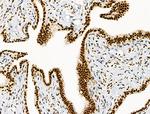 Phospho-SKP2 (Ser64) Antibody in Immunohistochemistry (Paraffin) (IHC (P))