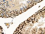 Phospho-SKP2 (Ser64) Antibody in Immunohistochemistry (Paraffin) (IHC (P))