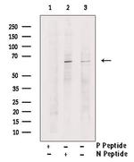 Phospho-SQSTM1 (Ser349) Antibody in Western Blot (WB)