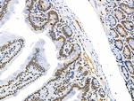 Phospho-SQSTM1 (Thr269, Ser272) Antibody in Immunohistochemistry (Paraffin) (IHC (P))