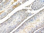 Phospho-SQSTM1 (Thr269, Ser272) Antibody in Immunohistochemistry (Paraffin) (IHC (P))