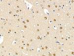 Phospho-SQSTM1 (Thr269, Ser272) Antibody in Immunohistochemistry (Paraffin) (IHC (P))