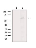 Phospho-SQSTM1 (Thr269, Ser272) Antibody in Western Blot (WB)