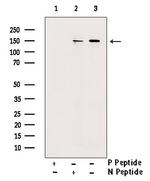 Phospho-SRC3 (Thr24) Antibody in Western Blot (WB)