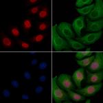 Phospho-SRC3 (Thr24) Antibody in Immunocytochemistry (ICC/IF)