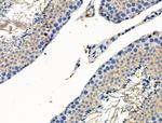 Phospho-SSH3 (Ser37) Antibody in Immunohistochemistry (Paraffin) (IHC (P))