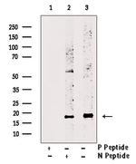 Phospho-Survivin (Thr34) Antibody in Western Blot (WB)