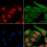 Phospho-Survivin (Thr34) Antibody in Immunocytochemistry (ICC/IF)