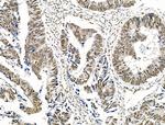 Phospho-Survivin (Thr34) Antibody in Immunohistochemistry (Paraffin) (IHC (P))