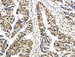 Phospho-Survivin (Thr34) Antibody in Immunohistochemistry (Paraffin) (IHC (P))