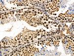 Phospho-Survivin (Thr34) Antibody in Immunohistochemistry (Paraffin) (IHC (P))