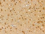 Phospho-Survivin (Thr34) Antibody in Immunohistochemistry (Paraffin) (IHC (P))