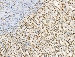 Phospho-Survivin (Thr34) Antibody in Immunohistochemistry (Paraffin) (IHC (P))