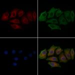 Phospho-TAK1 (Ser439) Antibody in Immunocytochemistry (ICC/IF)