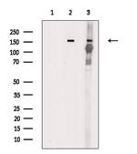 Phospho-TEK (Tyr992) Antibody in Western Blot (WB)