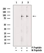 Phospho-TLK1 (Ser743) Antibody in Western Blot (WB)